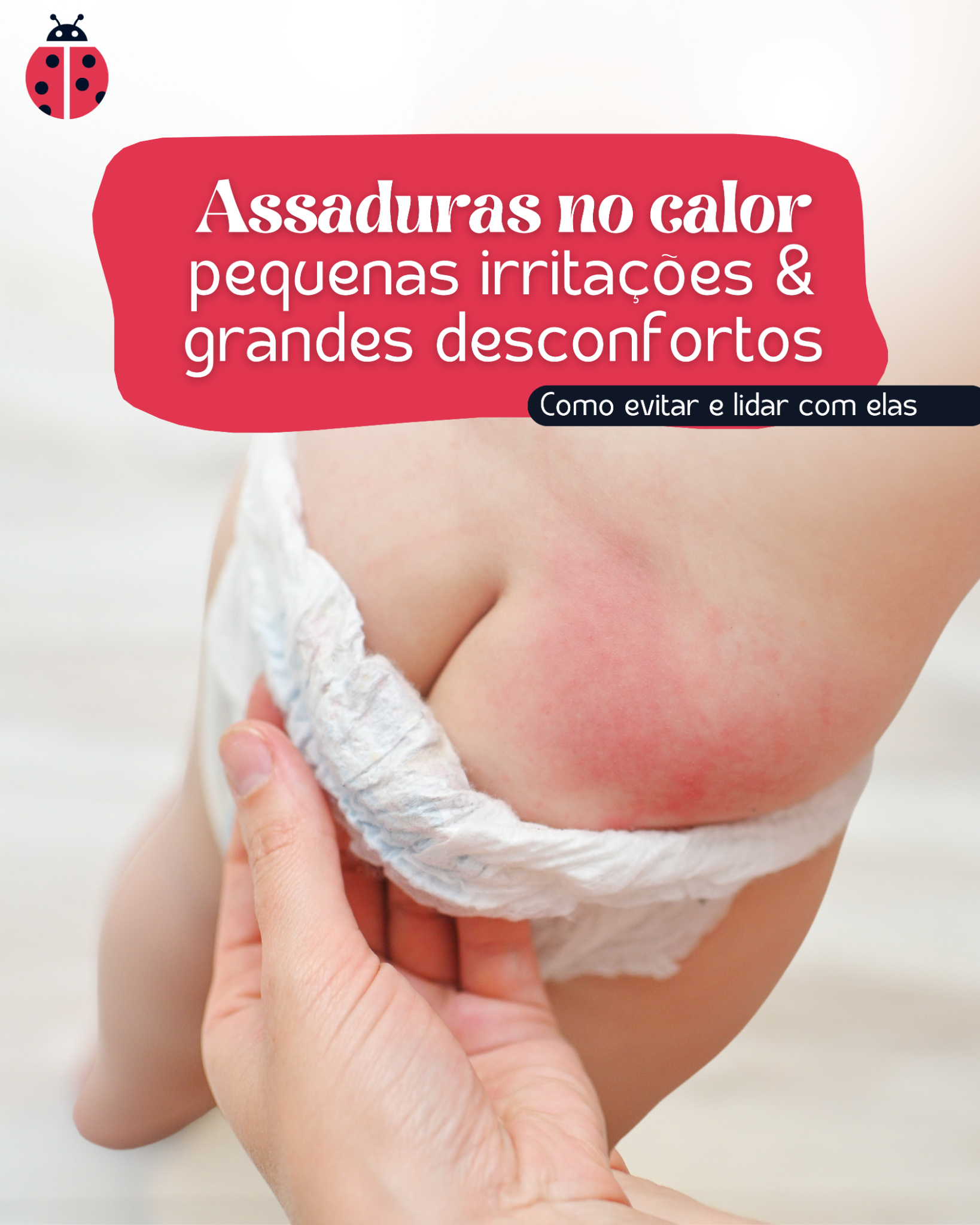 Post: Assaduras no calor